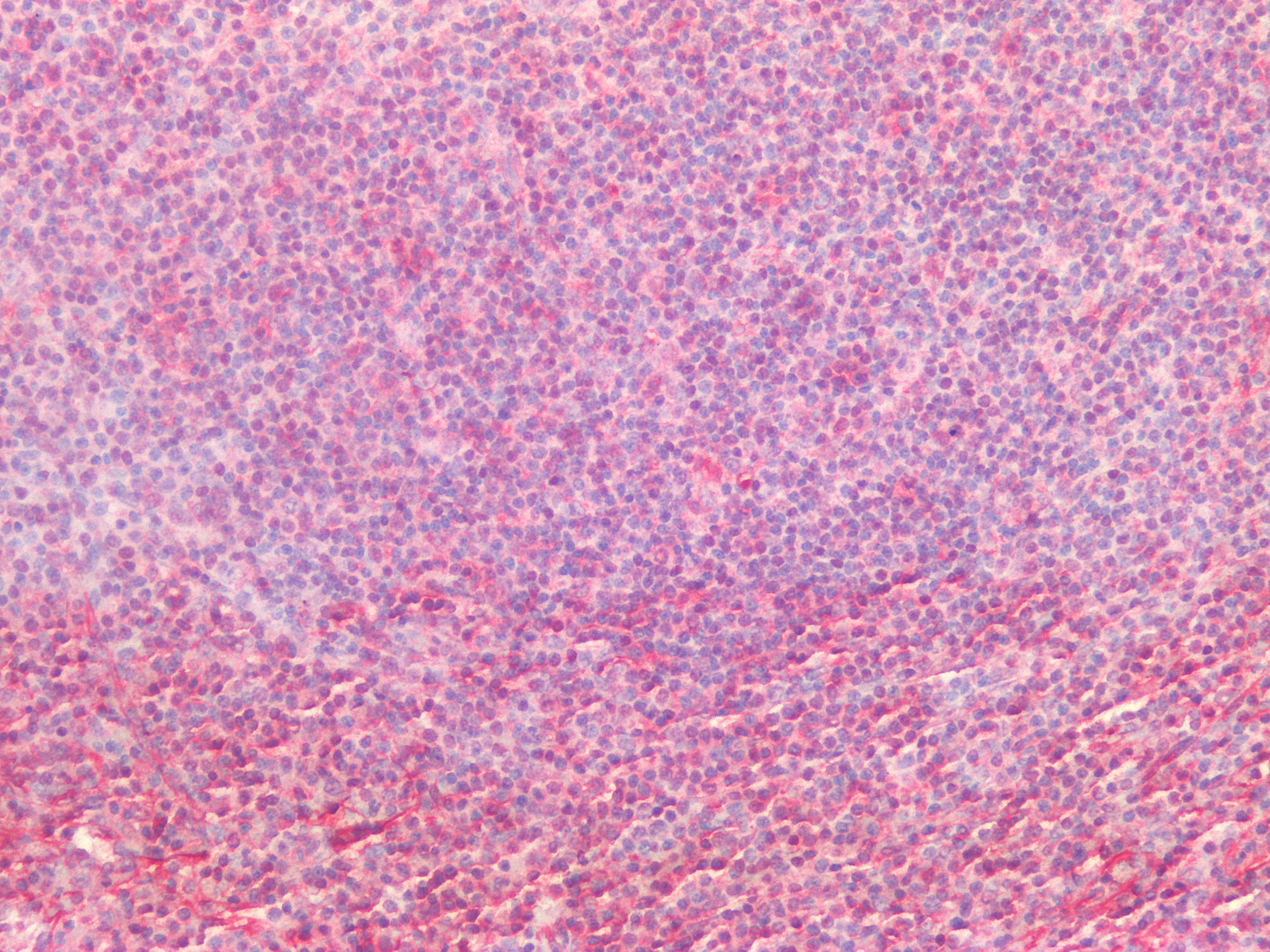 Figure 12. Immunohistochemistry on formalin fixed, paraffin embedded section of human spleen showing positive staining in connective tissue cells and lymphoid cells.